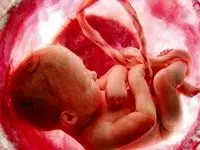 راز ۳۰ ساله در رحم مادر بیرجندی