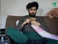 این پسر ۳  سال حمام نرفت!/ استاندار به ماجرا ورود کرد