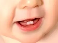 رابطه عجیب استرس مادران با دندان نوزاد