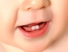 رابطه عجیب استرس مادران با دندان نوزاد