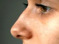 خبر بد برای ایرانی های دماغ عملی / قوز بینی مد شد!