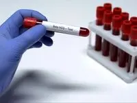 این ۵ آزمایش را بعد از ۴۰ سالگی انجام بدهید