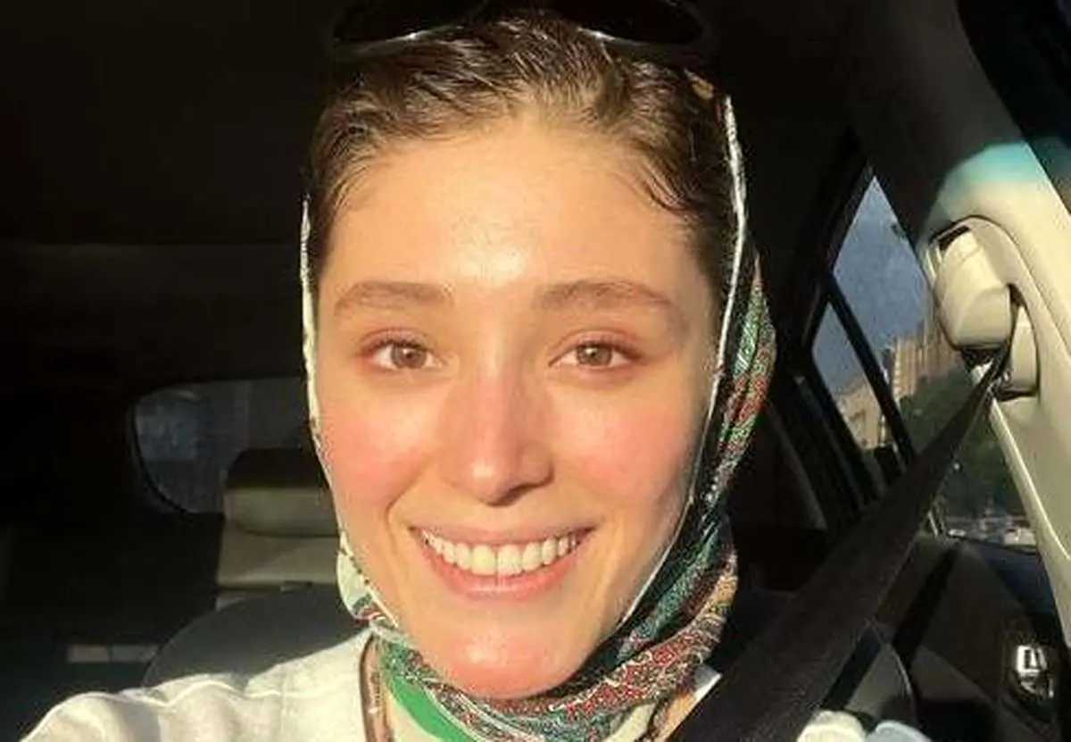 عکس فرشته حسینی با چشم کبود که حسابی وایرال شد!